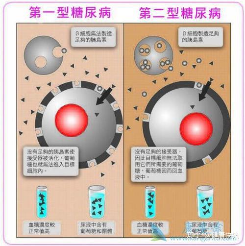 干细胞通过定向诱导分化胰岛β细胞,为治疗2型糖尿病带来新希望