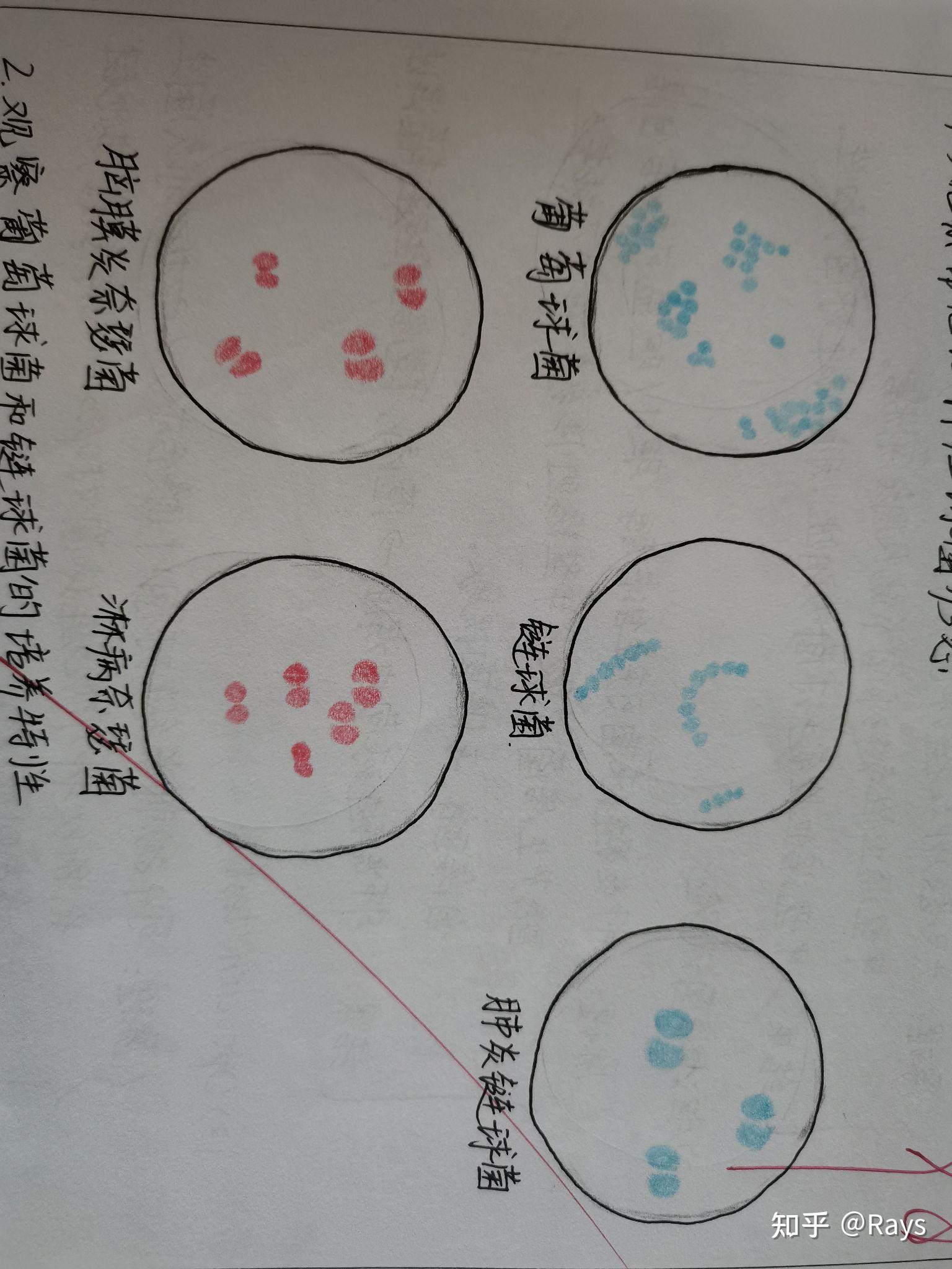 厌氧菌葡萄球菌,链球菌,肺炎链球菌,脑膜炎奈瑟菌,淋病奈瑟菌1.