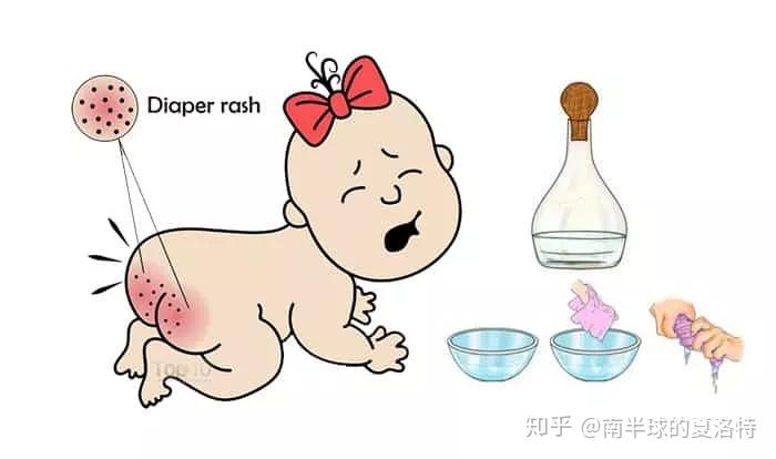母婴湿疹痱子一次性说清楚宝宝的各种皮肤问题