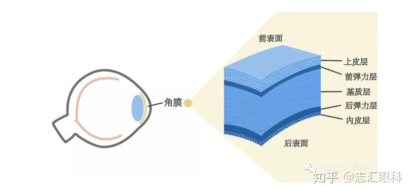 戴ok镜会让角膜变薄吗