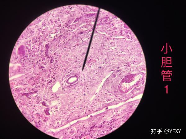 病理学 红蓝铅笔绘图