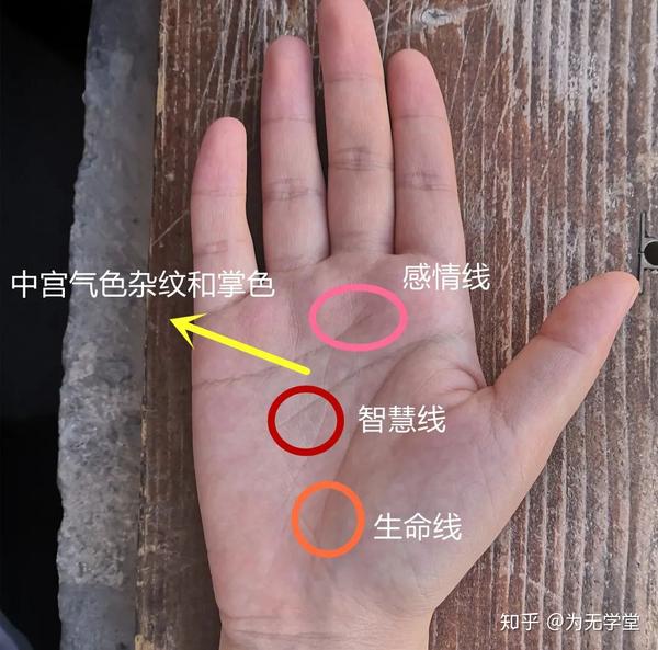 莫名的烦躁郁闷焦虑抑郁你经历过吗