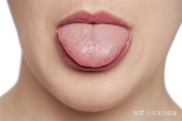 白色舌苔可分为两类,首先,舌头很轻,如果这类人同时伴有疲劳,心律失常