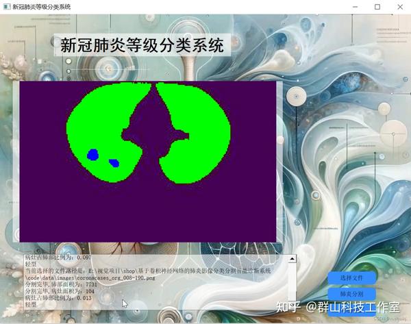 基于卷积神经网络的肺炎影像分类分割智能诊断系统 知乎