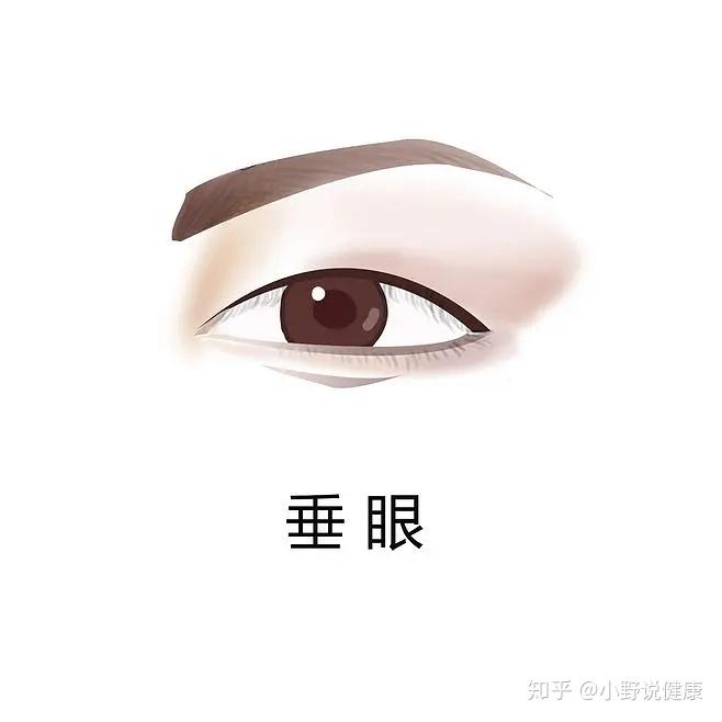 如何判断自己是哪种类型的眼睛