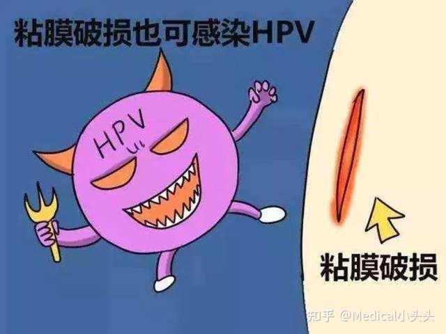 hpv病毒感染会得什么病