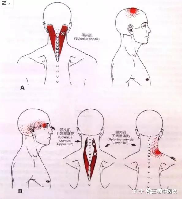 简单易学自我拉伸保养颈椎之三头夹肌与颈夹肌的自我拉伸