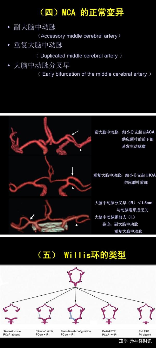 无论是颈内动脉系,椎一基底动脉还是连接他们的willis环均位于脑的腹