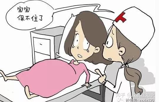 人流综合征 zhuanlan.zhihu.com