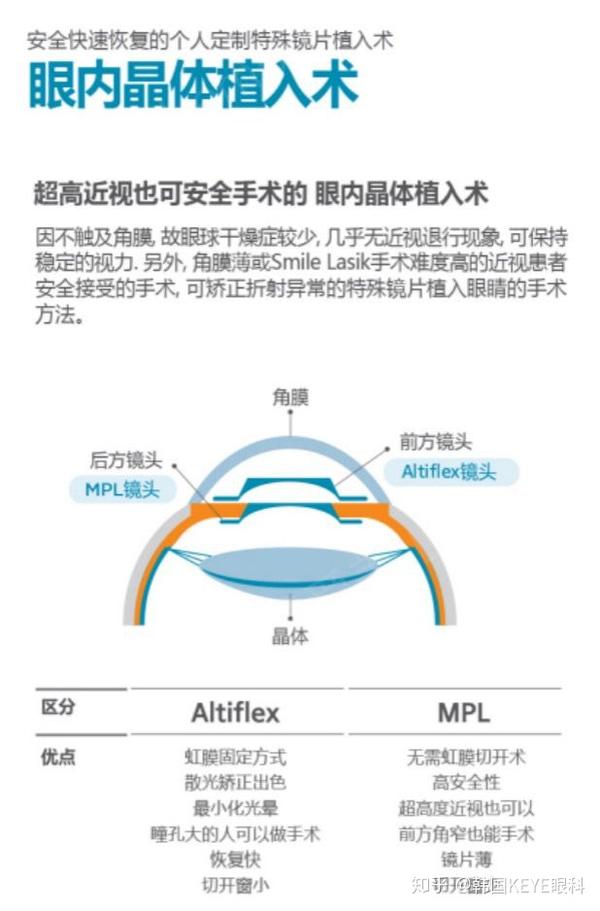 晶体植入用来治疗近视眼好吗?