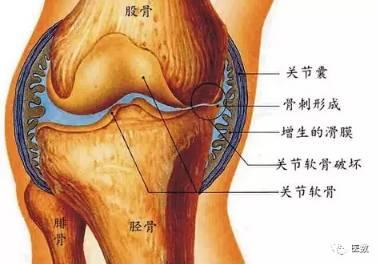 膝关节滑膜治疗方法,你知道炎几种?