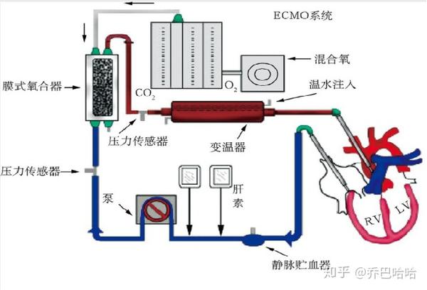 2,ecmo的原理