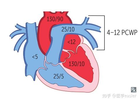 心输出量减少 知乎