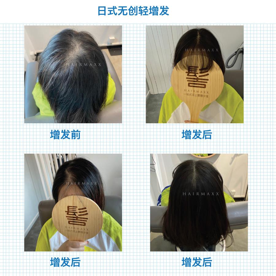 轻增发只需几小时 没错 聊聊天就是多毛星人了
