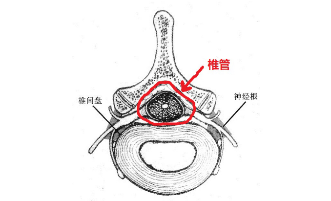 椎管狭窄常见的症状有哪些