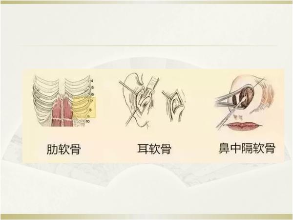 鞍鼻整形,一个让人羡慕的鼻子