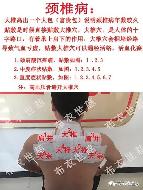 失眠多梦易醒,很可能是颈椎在报警!