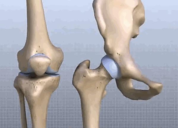 左→右:踝关节,膝关节,髋关节对比示意图