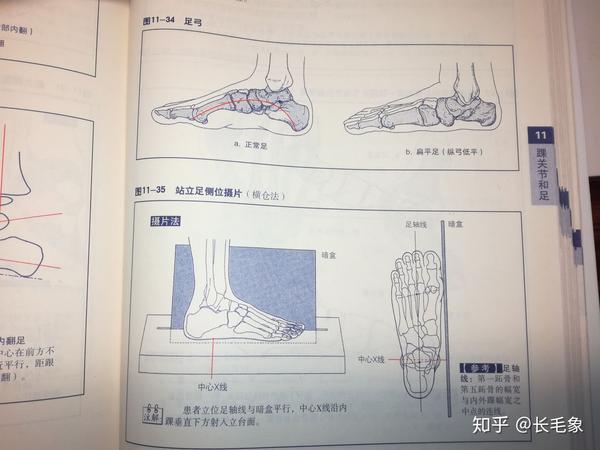 图片来源 骨与关节x线摄片及读片指南 第7版