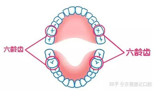 儿童牙齿关于612岁小朋友常见的口腔问题