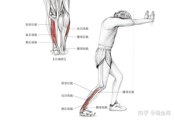 为何崴脚的总是受伤的那只脚呢脚踝扭伤的拉筋康复