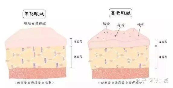 那是因为我们的皮肤中的真皮发生了剧烈的变化!