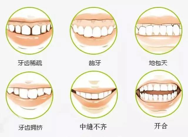 刚戴上牙套牙齿就痛,这是正常的吗?