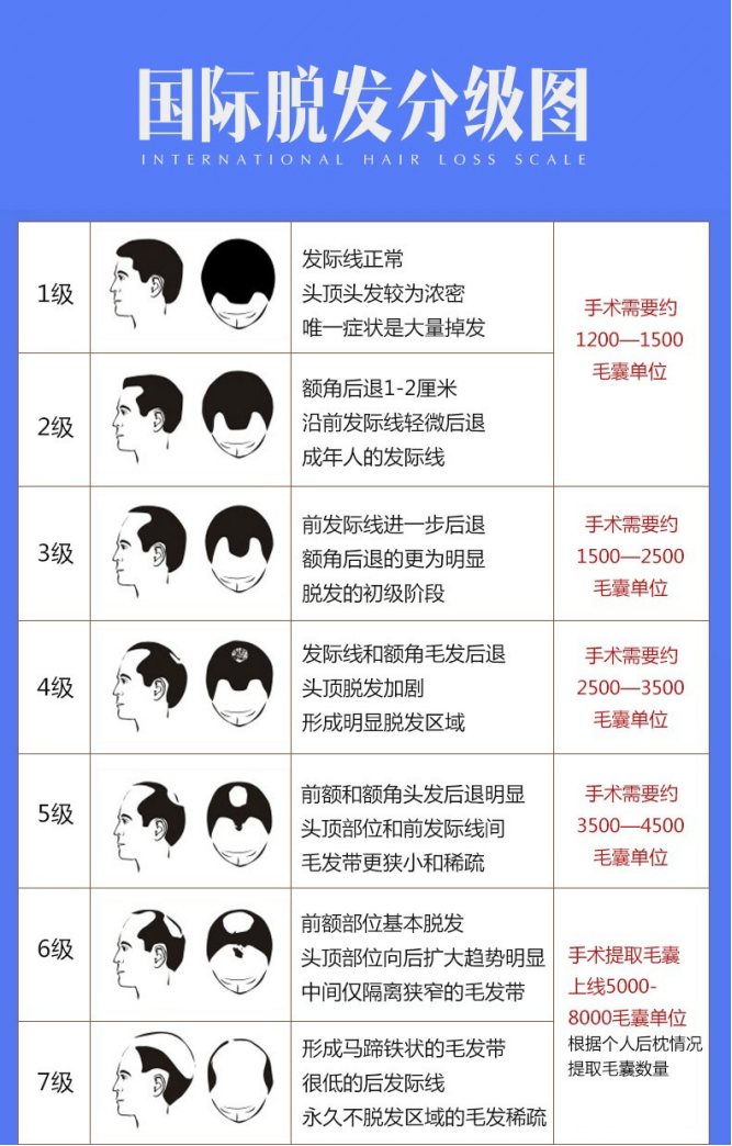 对应的脱发等级不同,要移植的毛囊数量就不同,脱发越严重,需要种植的