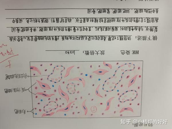 病理学切片红蓝铅笔绘图