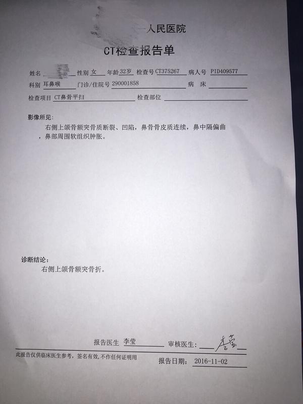 上颌骨额突骨折需要治疗吗?