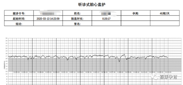 高能干货——如何读懂胎心监护曲线?