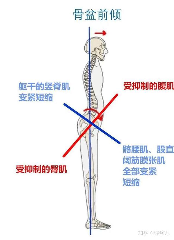 如果在这个时期姿势不良或发生扭伤,很容易造成骨盆错位歪斜