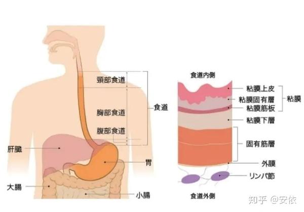 科普食管癌