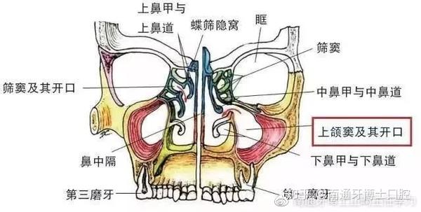 上颌窦炎