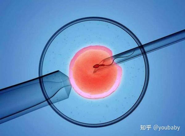 试管婴儿与人工授精傻傻分不清楚?其实两者区别挺大的