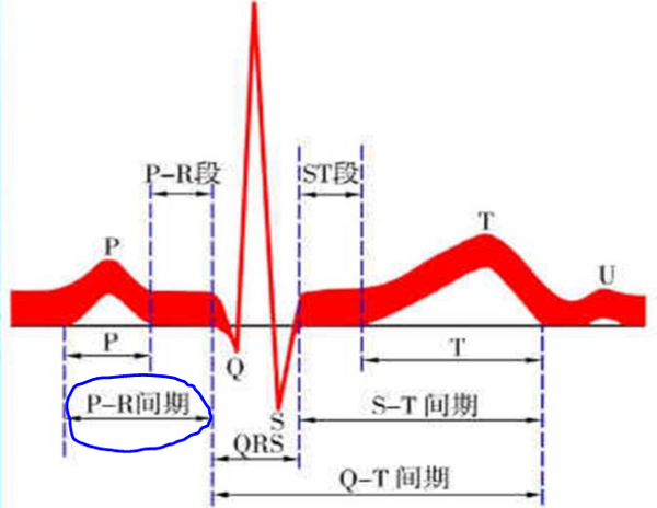 心电图part3看图形看小格
