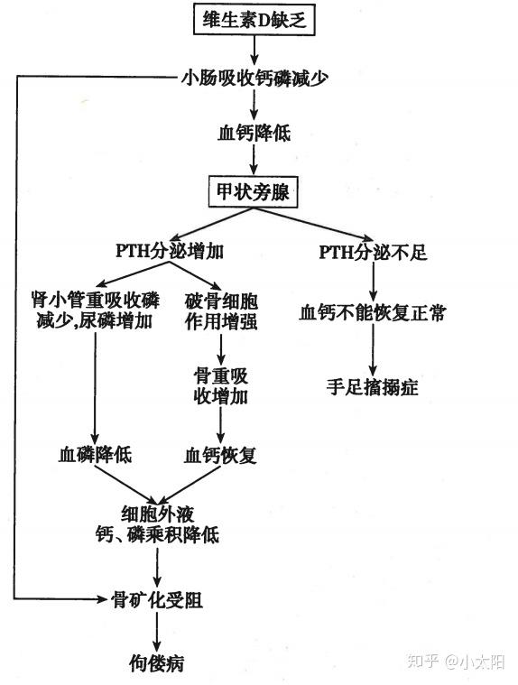 佝偻病