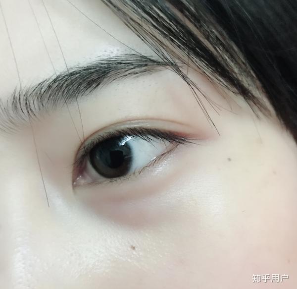 能看出来吗,左眼还好,右眼就时单时双,多层眼皮.