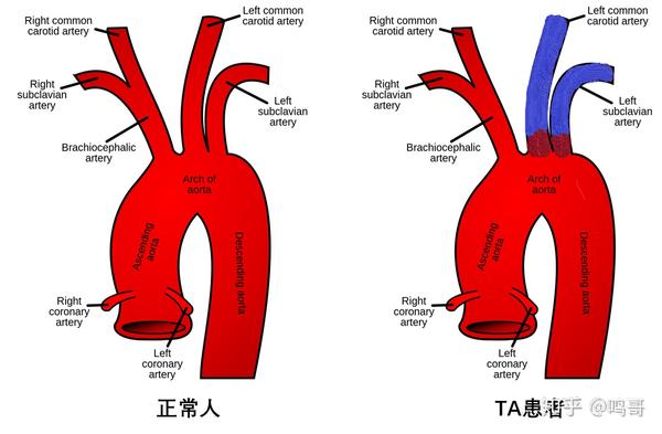 在解剖学上红色代表动脉血,蓝色代表静脉血,全身器官组织