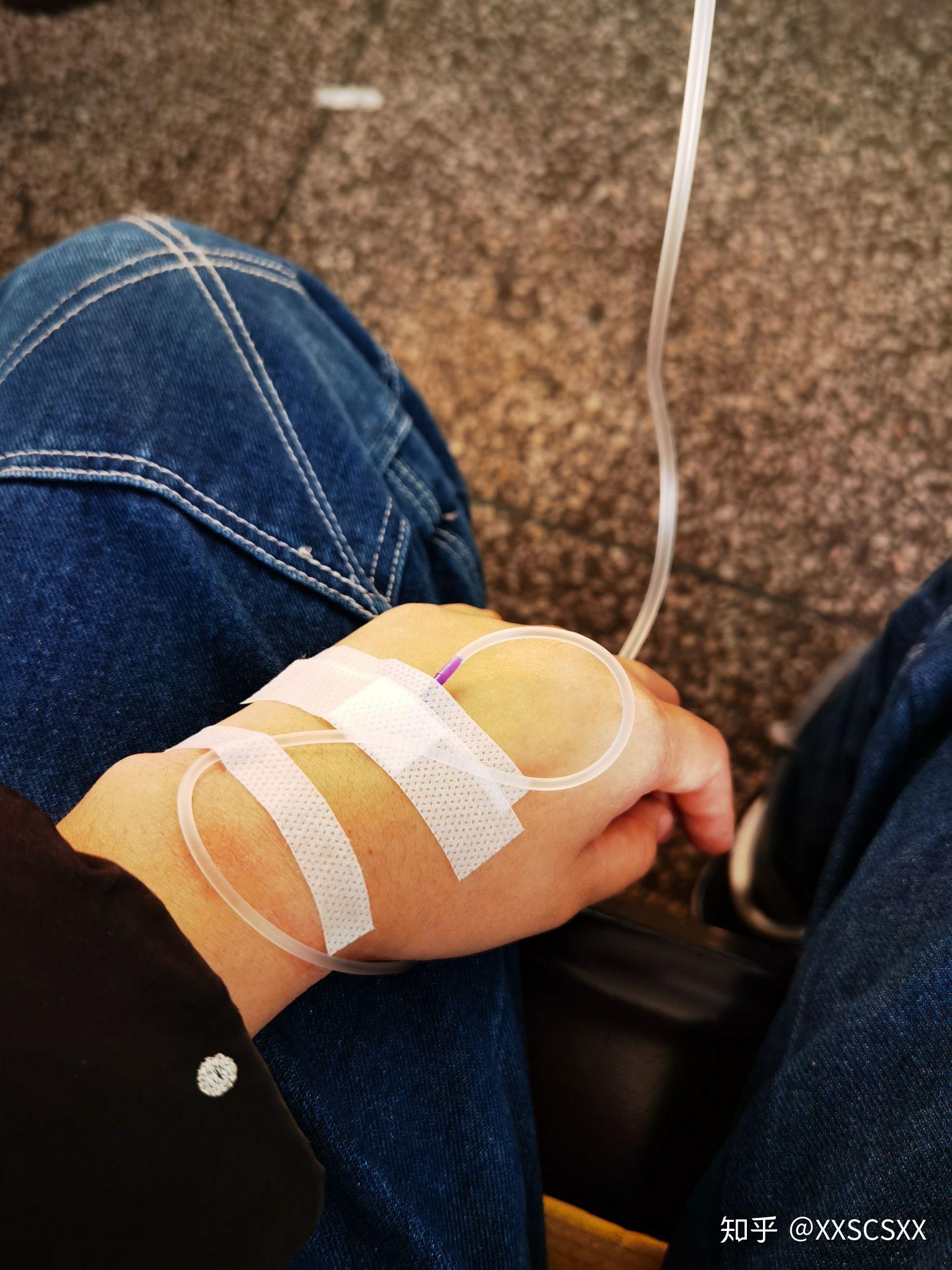 打点滴 知乎