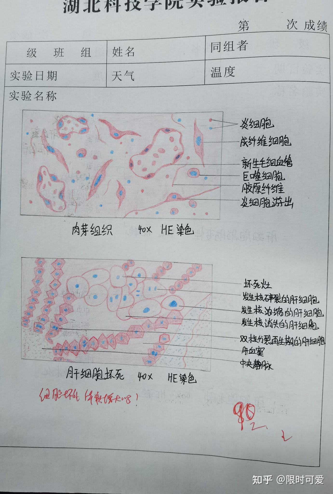 病理红蓝铅笔图