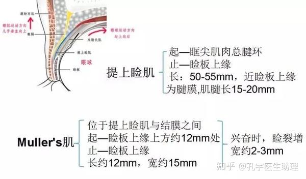 适应证:轻度上睑退缩,可矫正退缩2mm 二,睑板前提肌延长术 适应症