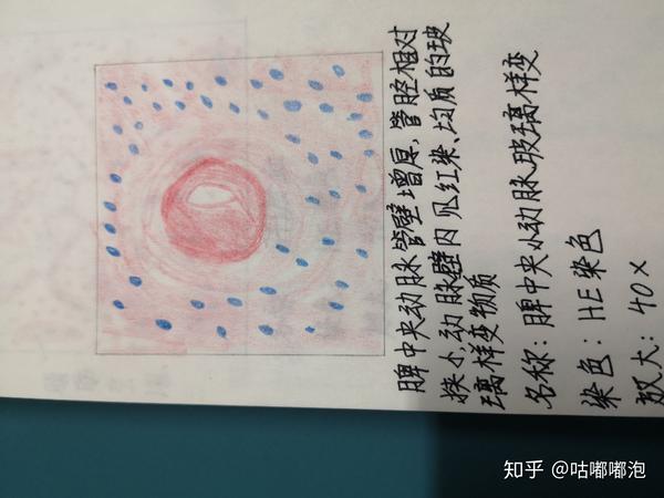4.肉芽组织