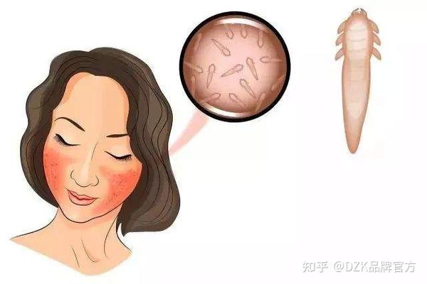 脸上都会有污垢和老废的角质,没有及时清除就会阻塞毛囊口,引发细菌