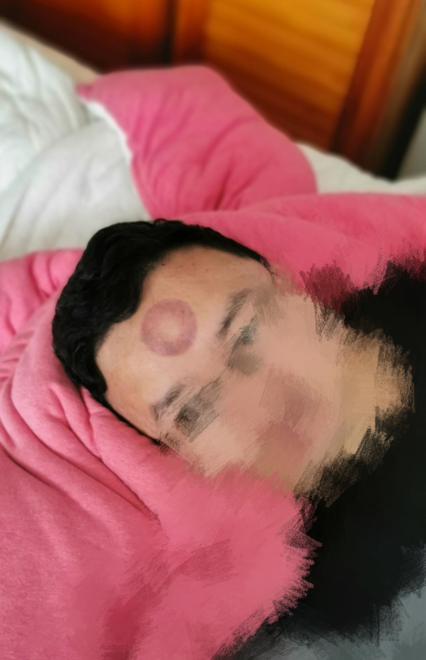 器好不好用:也不知道怎么就脑子智障了,把拔罐器就这么往脑门上一扣