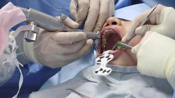 手术实录|机器人如何辅助医生完成精准种植牙手术?