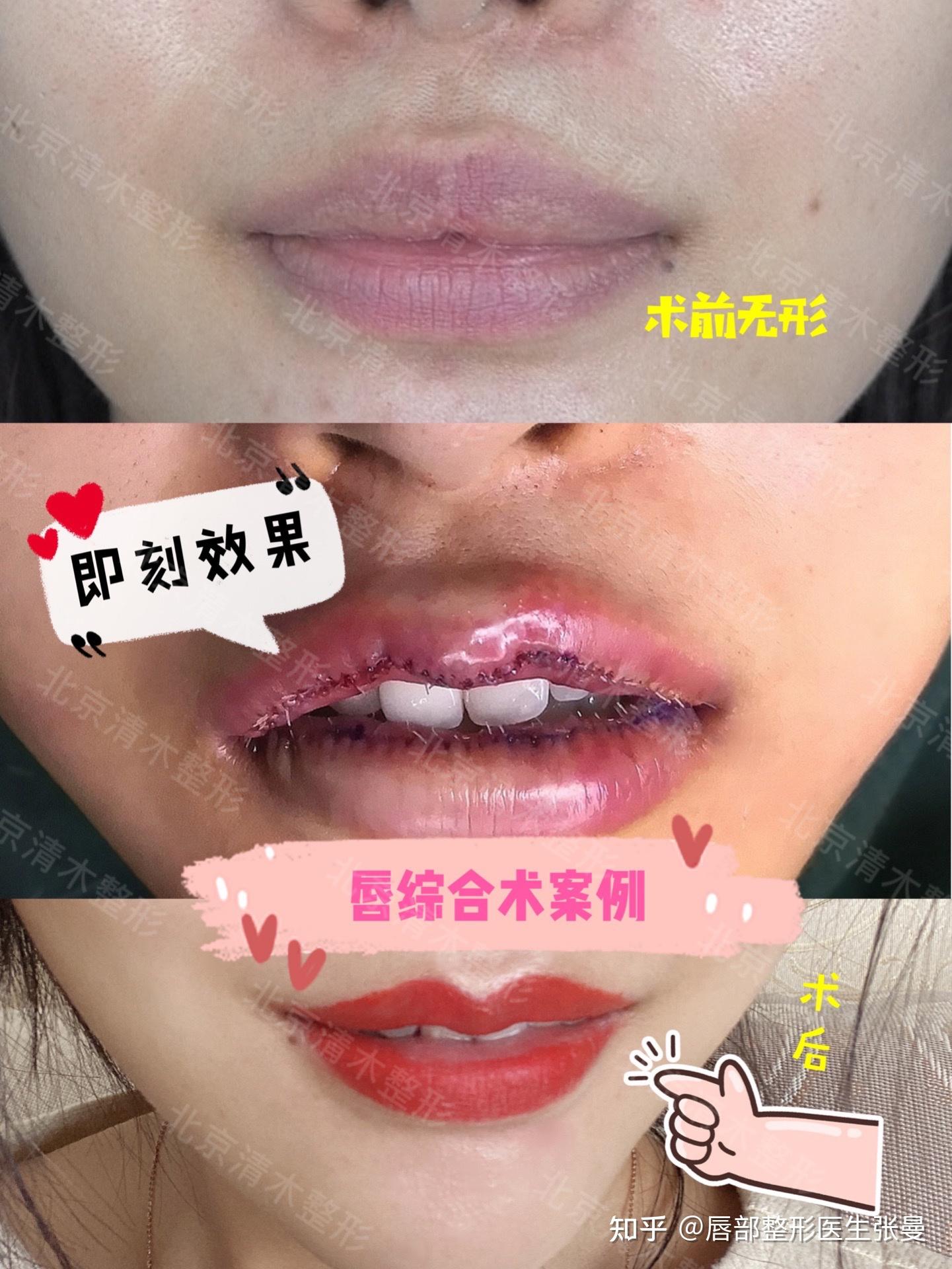 上嘴唇比下嘴唇厚是什么原因?
