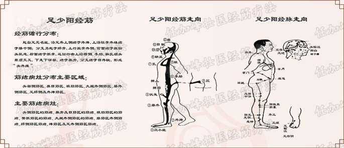 连载《黄帝内经·灵枢·经筋第十三》-足少阳之筋