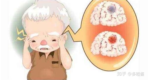 缺血,缺氧所致的局限性脑组织的缺血性坏死或软化,临床表现症状比较多