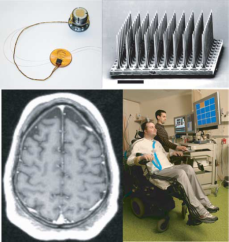 植入式脑机接口技术——现实中的"神经蕾丝"计划
